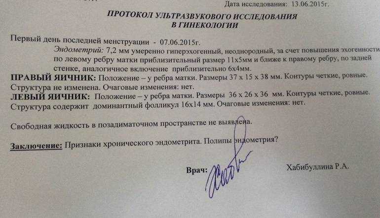 Фолликулометрия: на какой день делается, нормальные показатели овуляции на узи