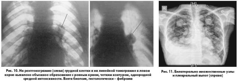 Узи – ультразвуковые исследования
