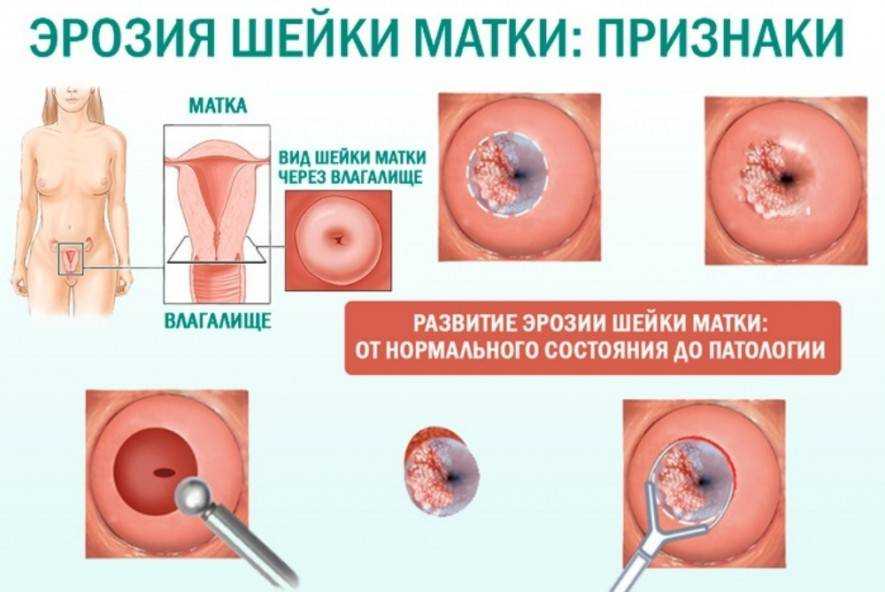 Северо-западный центр малоинвазивной гинекологии