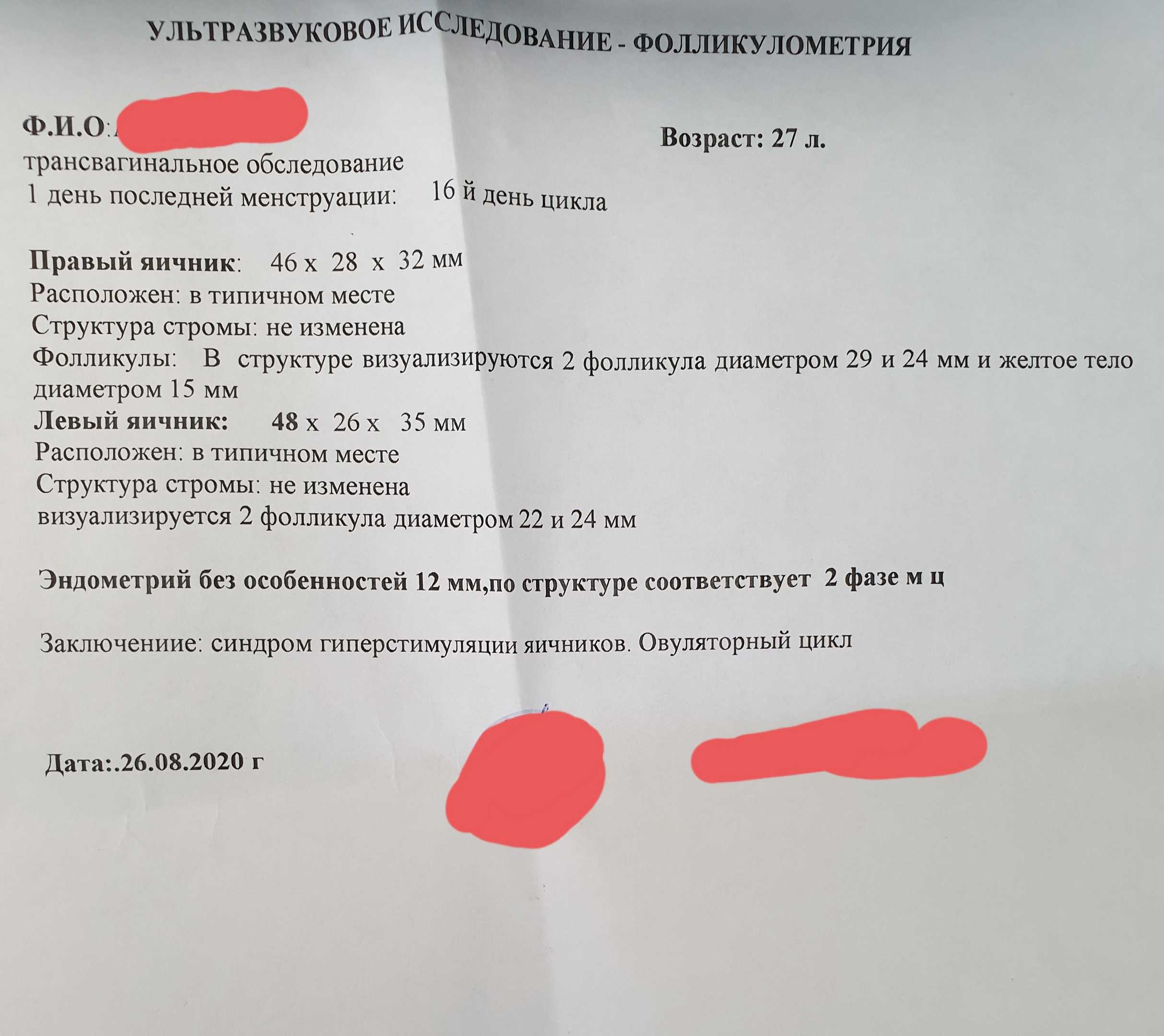 Узи яичников для выявления овуляции. показания и результаты. как проводится? :: polismed.com
