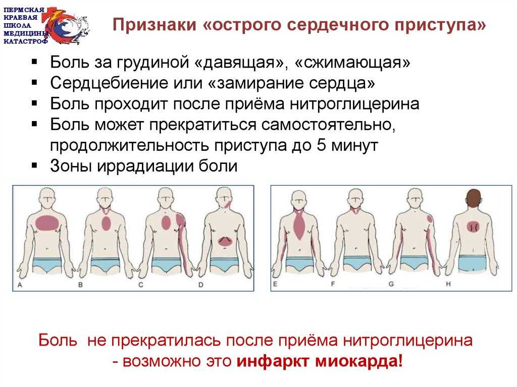 Боль за грудиной это где в картинках у женщин