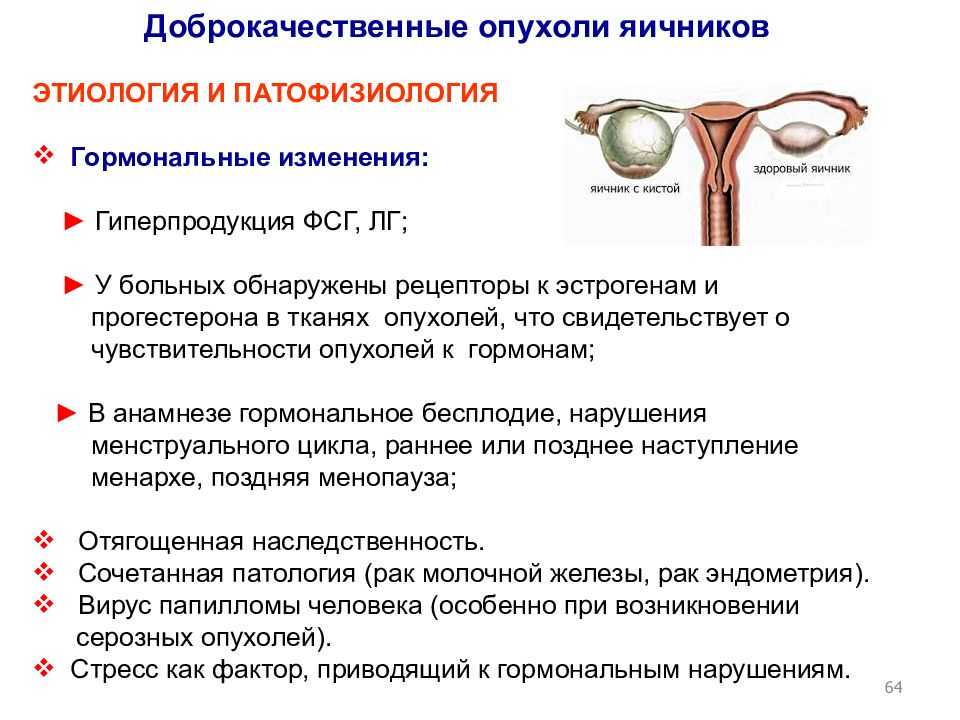 Варианты осложнений при доброкачественных опухолях яичника дающие острую клиническую картину