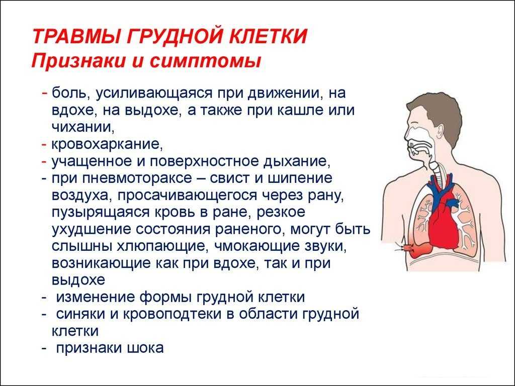 Боль в грудной клетке план ухода