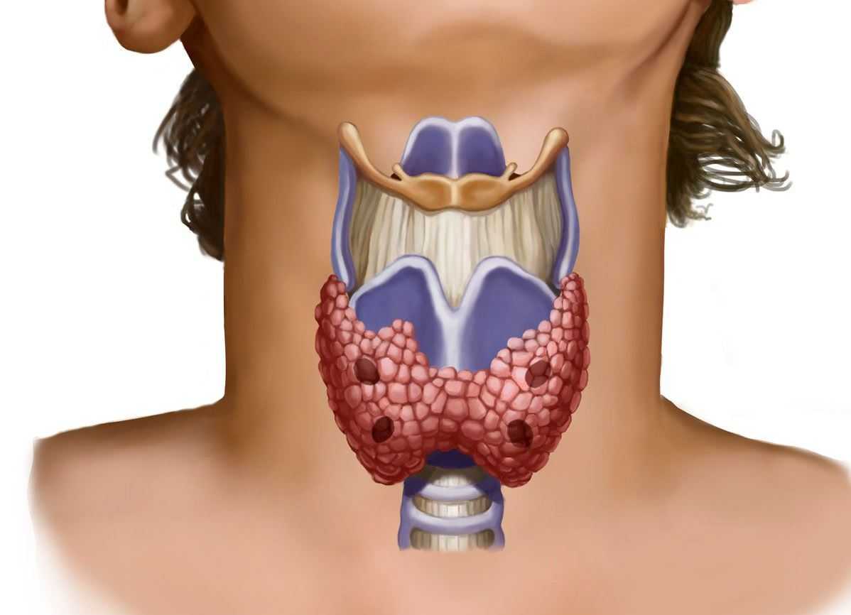 Заболевания щитовидной железы у женщин: симптомы, анализы и лечение