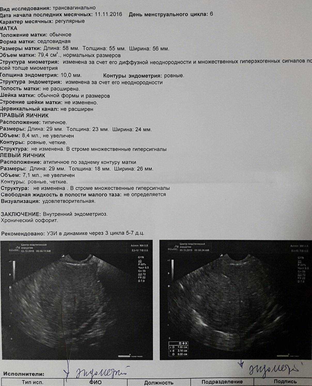 Матка 12 мм. 16 Недель беременности цервикометрия норма. УЗИ шейки матки цервикометрия. Цервикометрия заключение УЗИ. Длина матки.