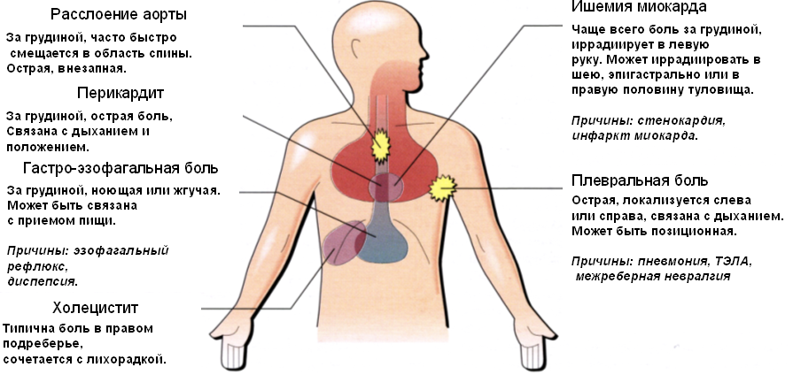 Боль за грудиной это где в картинках