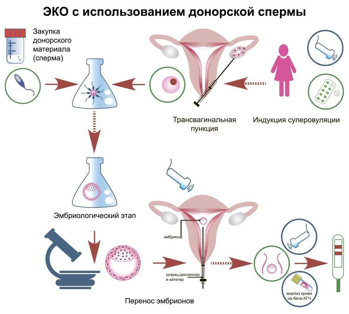 банк донорских яйцеклеток в москве