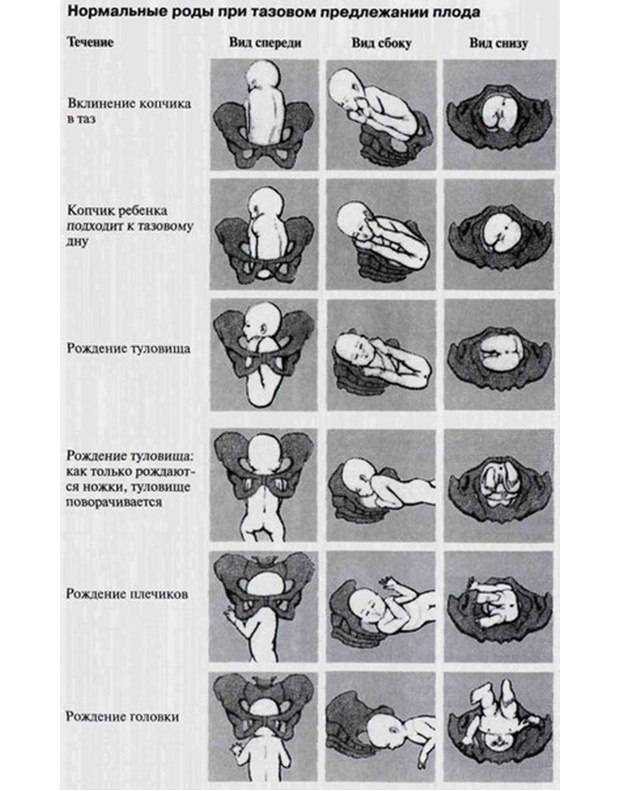 Роды в головном предлежании. Ягодичное предлежание плода позиция 1. Тазовое предлежание 1 позиция передний вид. Головное косое предлежание плода. Продольное головное предлежание 2 позиция.