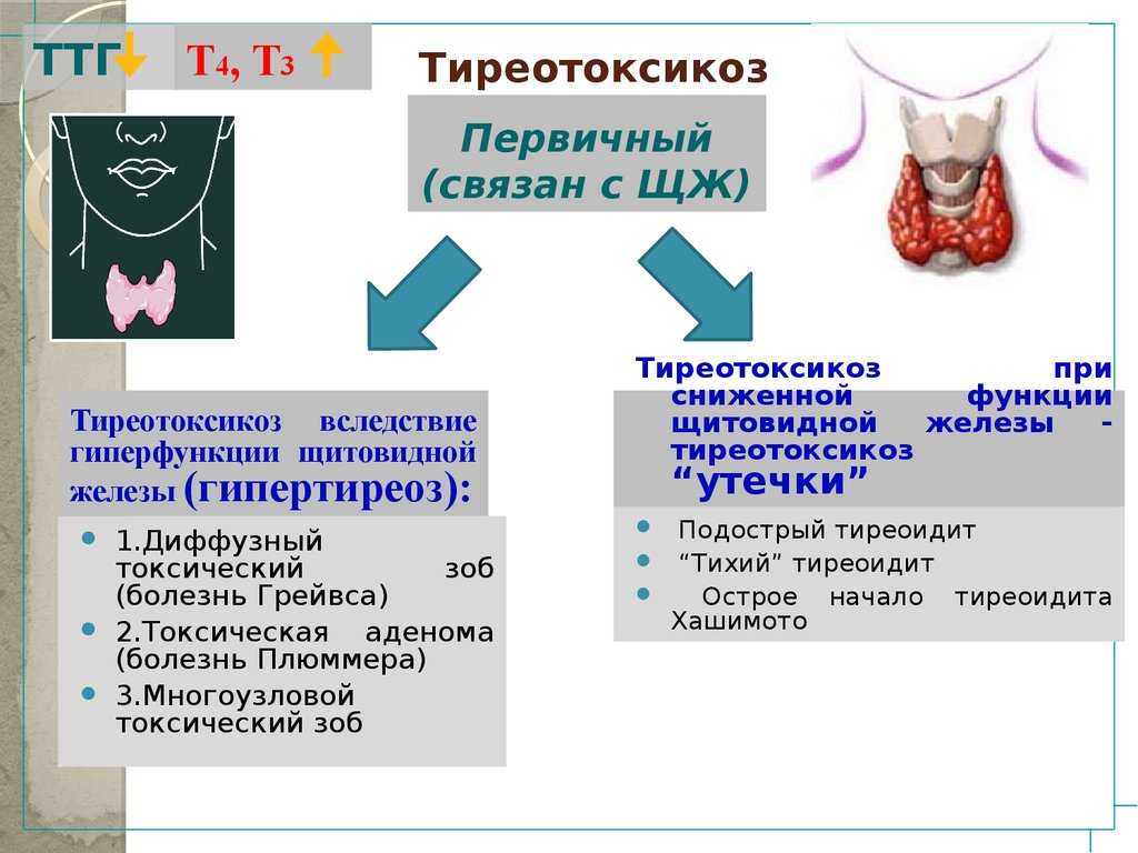 Гипертиреоз и тиреотоксикоз