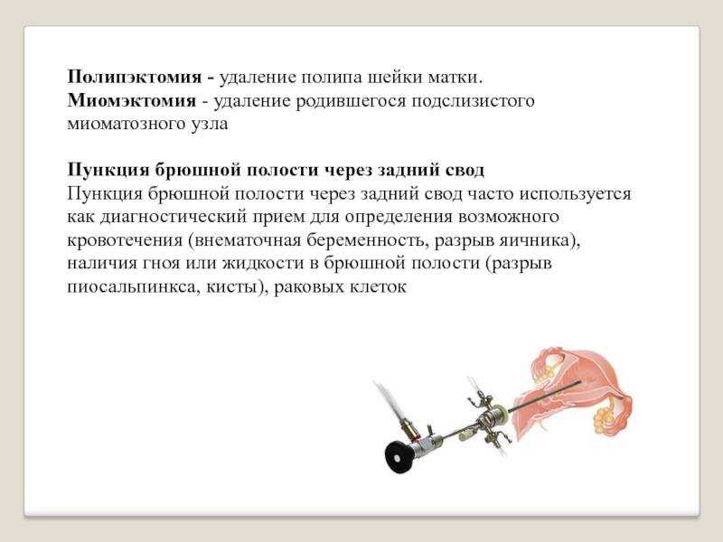 Для чего проводят гистероскопию перед эко