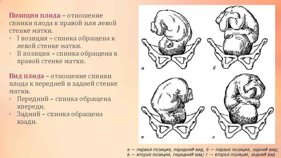 Положение плода продольное головное предлежание это как фото