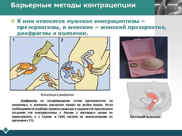 Рейтинг надежности методов контрацепции | университетская клиника