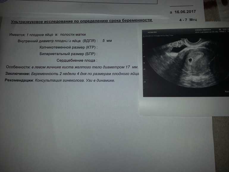 Беременность 4 недели видна на узи
