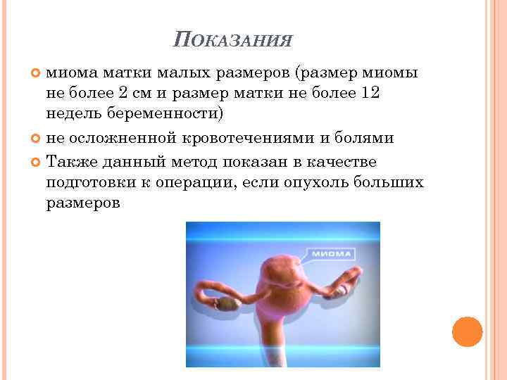 Миома матки при беременности: влияние на зачатие, осложнения, диагностика и лечение