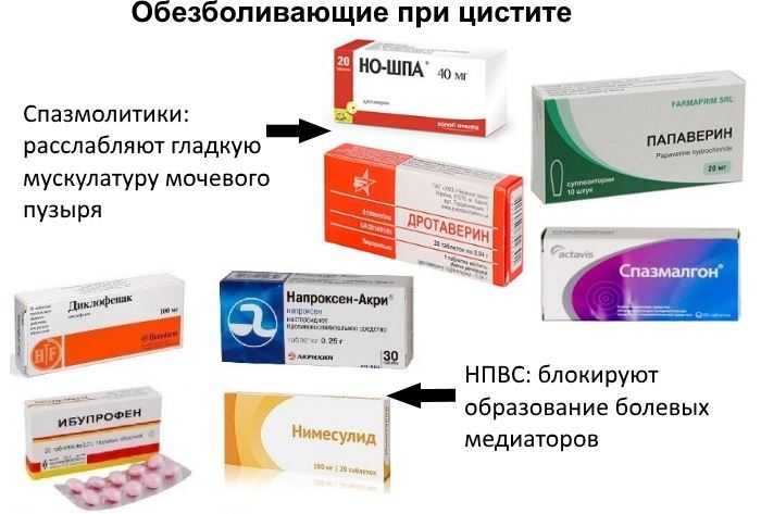 Цистит: диагностика, лечение, запись на прием к врачу - международная клиника медика24