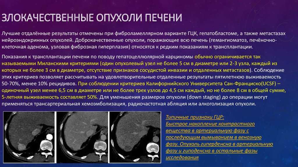 Узи малого таза при бесплодии. показания, какие органы исследуются, как производится, возможные результаты :: polismed.com