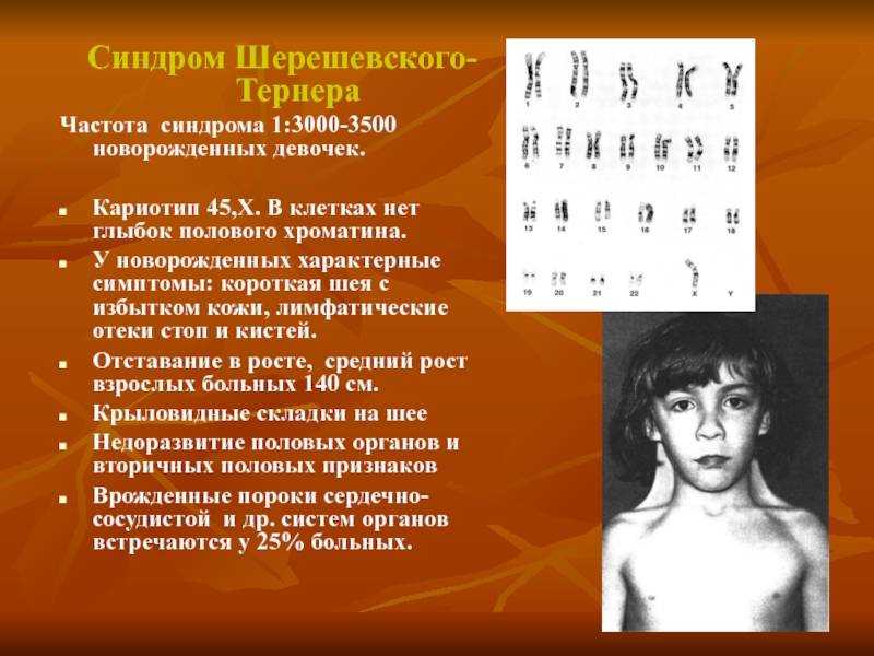 Исследование кариотипа - как делают, расшифровка результата | университетская клиника
