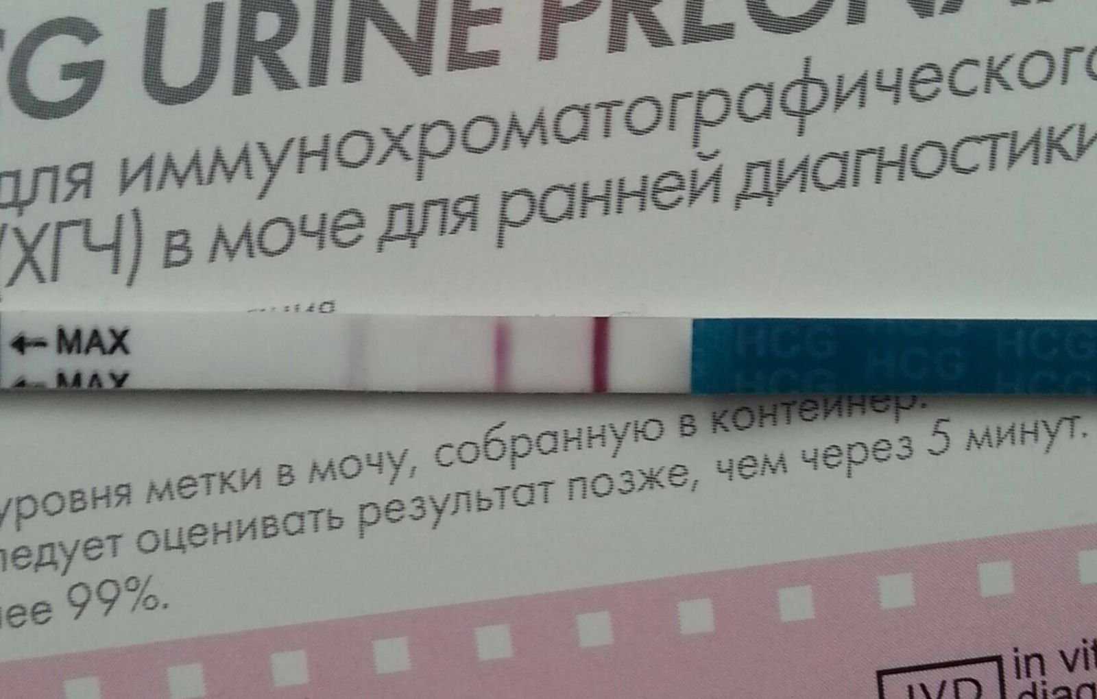 Беременность с одной трубой: что нужно знать? - семейный медицинский центр "лейб медик"
