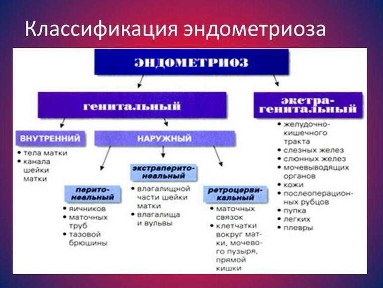 Эндометриоз - причины, симптомы, современная диагностика, эффективное лечение болезни