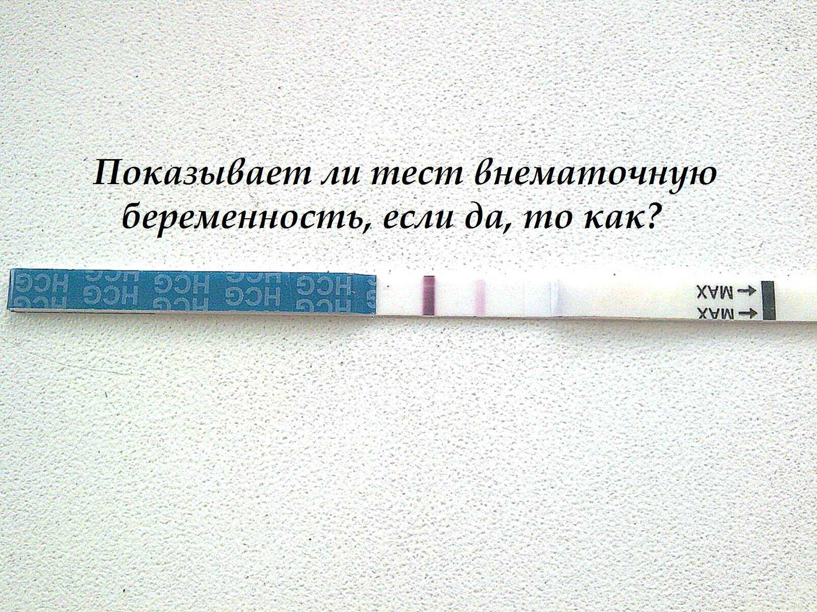 Внематочная беременность: диагностика | университетская клиника