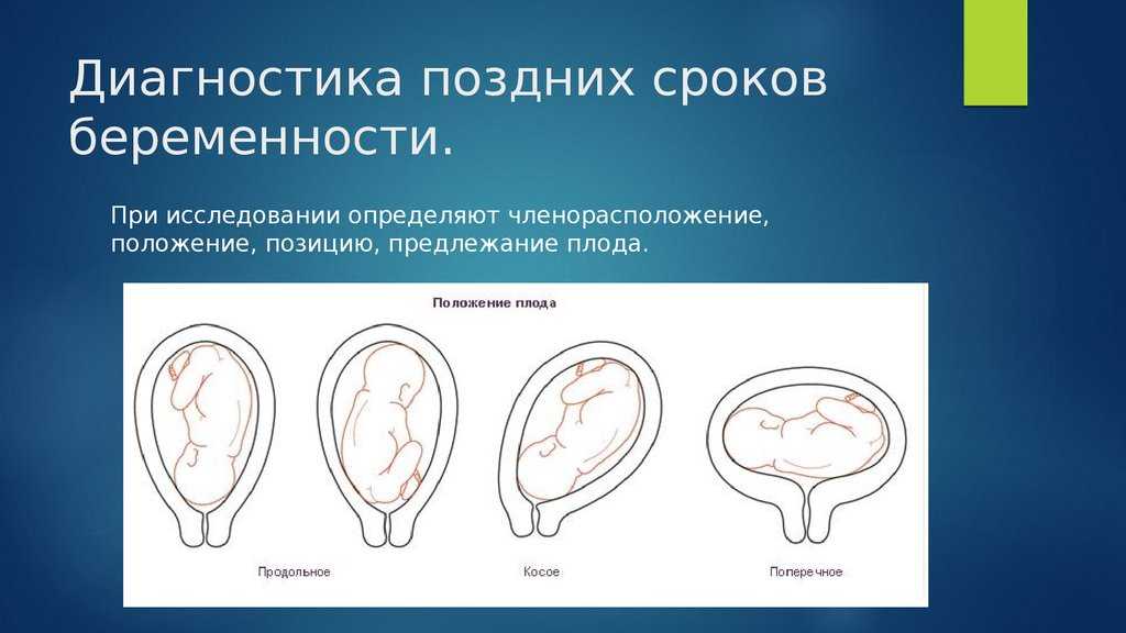 Диагностика беременности