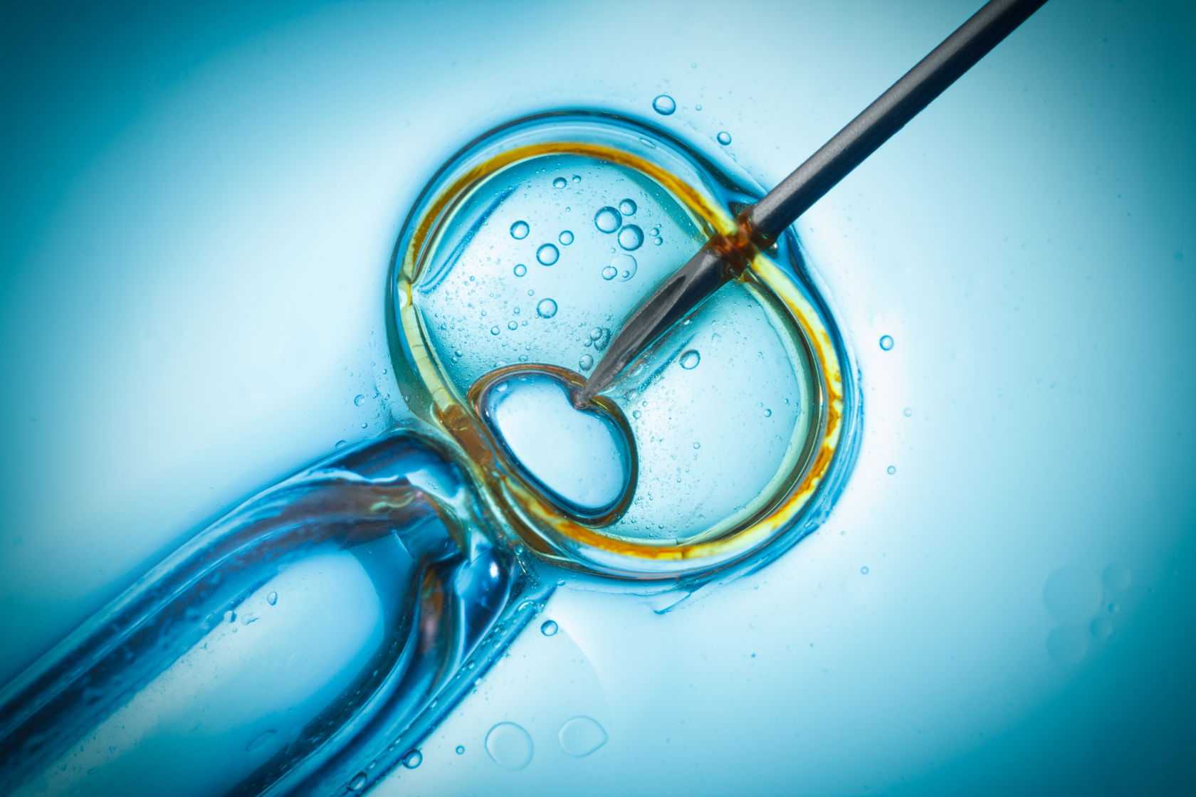 Ivf – вспомогательные репродуктивные технологии