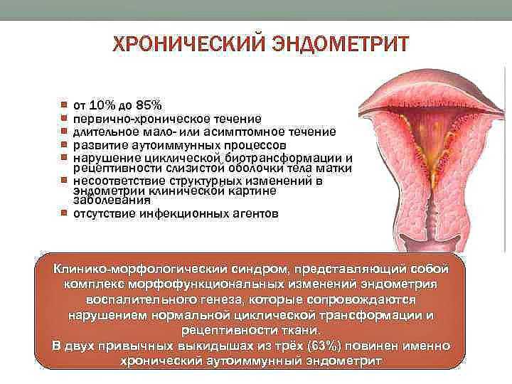 Воспаление матки у женщин симптомы и лечение. Хронический эндометрит матки. Цервицит метроэндометрит. Болезнь матки эндометрит. Воспаление слизистой оболочки матки.
