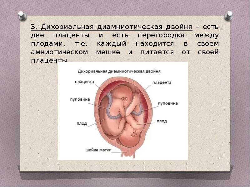 Узи при многоплодной беременности | центр медицины плода «медика»
