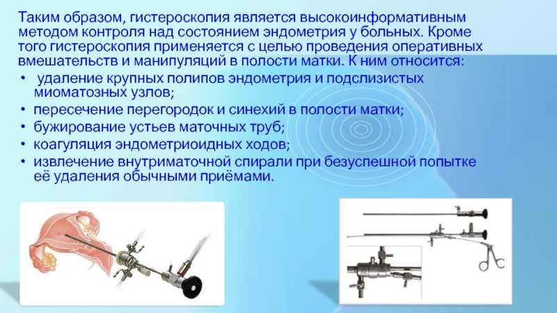 Гистероскопия матки презентация