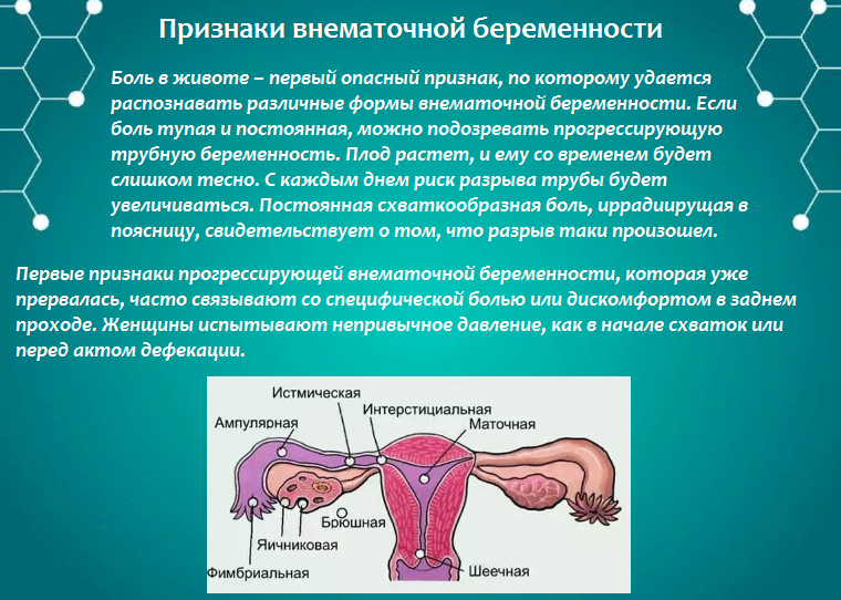 Проявления внематочной беременности