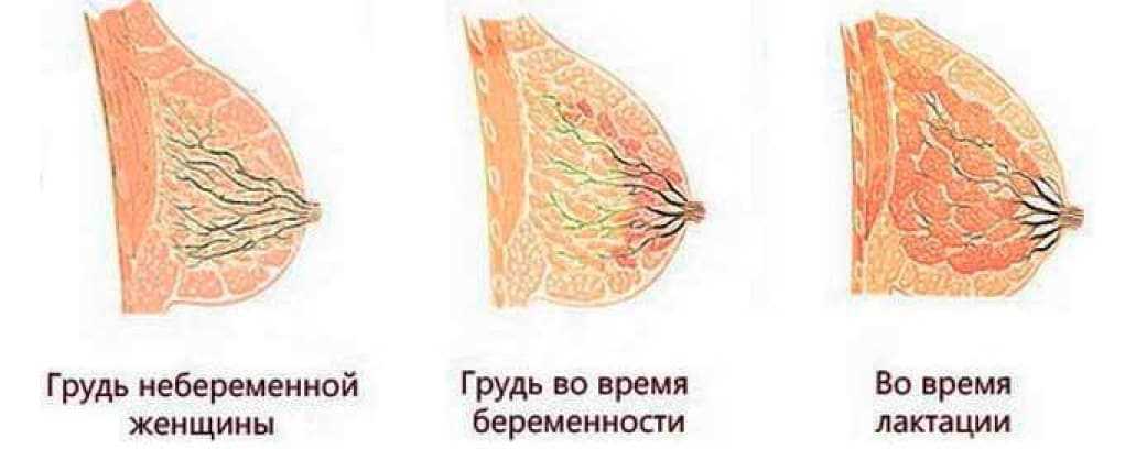 Перестала болеть грудь во время беременности – что это значит?