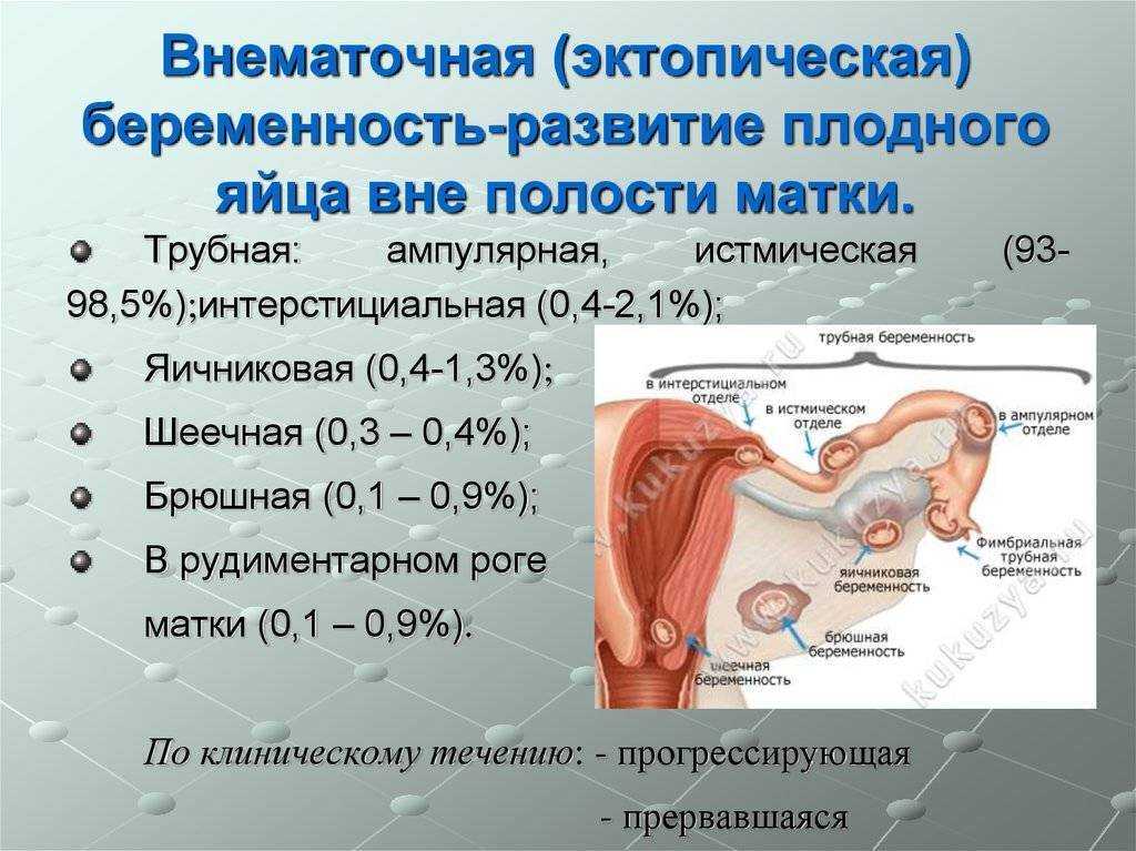 Матка и трубы расположение картинки