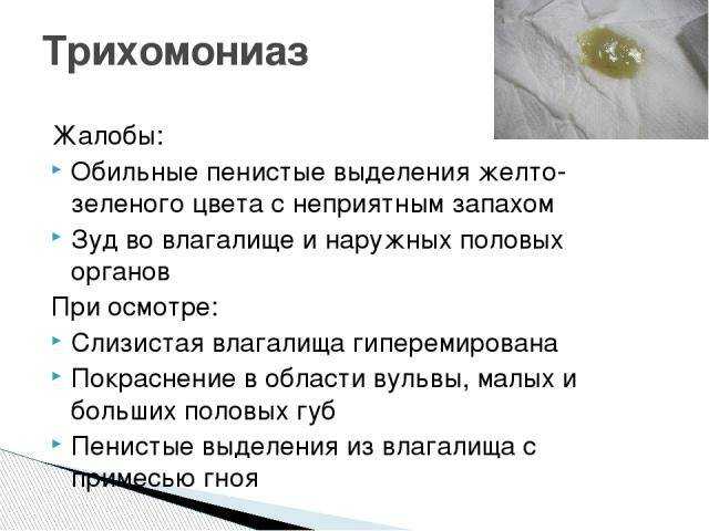 Выделения из половых путей