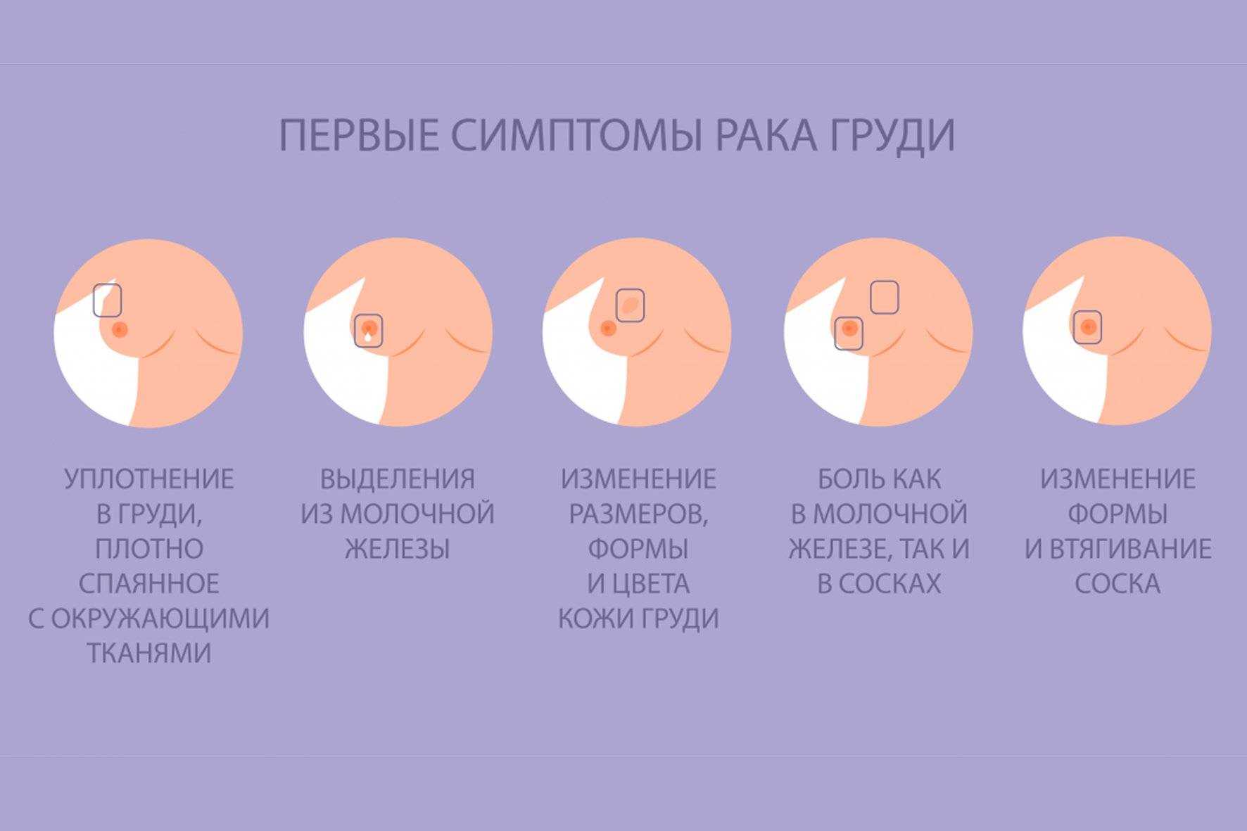 Изменения груди во время беременности