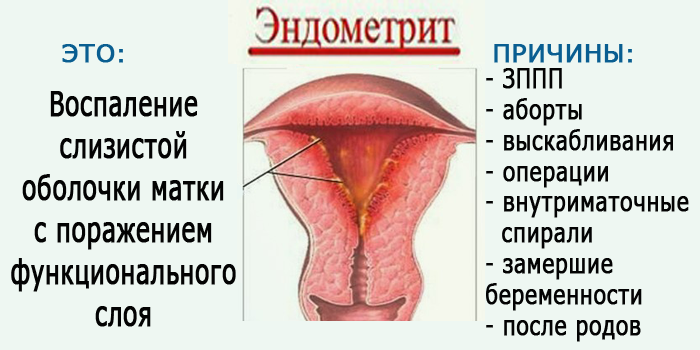 Внутреннее воспаление матки. Острый эндометрит матки. Острый эндометрит симптомы. Эндометрит воспаленный. Острый и хронический эндометрит.