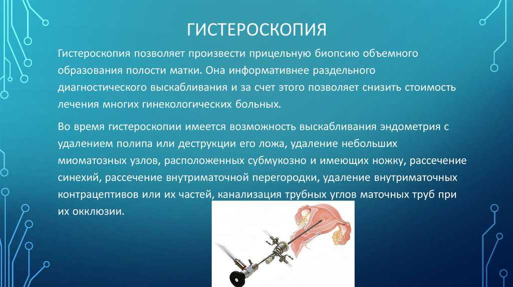 Какое время выскабливания. Биопсия полипа эндометрия. Гистероскопия этапы операция. Операция гистерорезектоскопия полипа эндометрия. Гистероскопия методика.