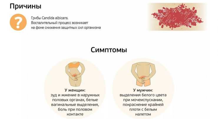 Выделения из половых путей: норма и патология у женщин