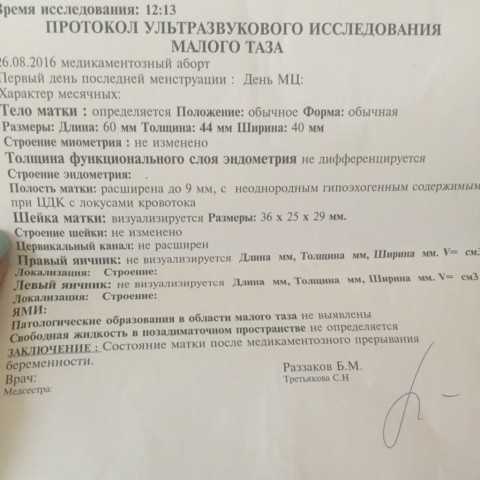 Плодное яйцо: что это такое, размеры по неделям беременности, как выглядит на раннем сроке по узи