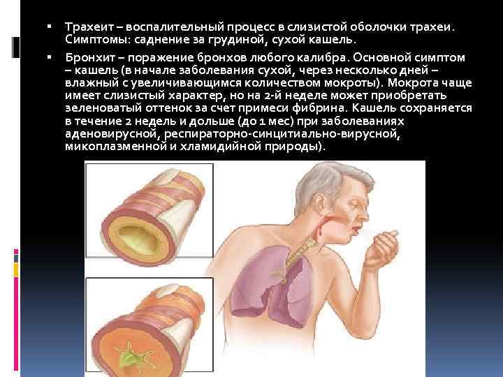 Трахеит карта вызова скорой