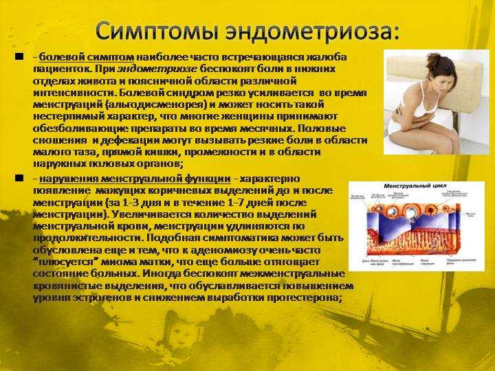 Эндометриоз