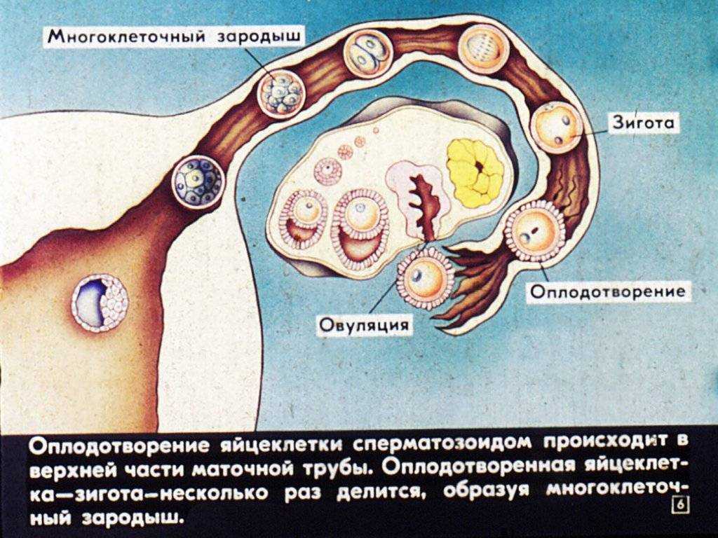 Искусственное оплодотворение