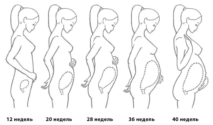 Увеличение матки при беременности