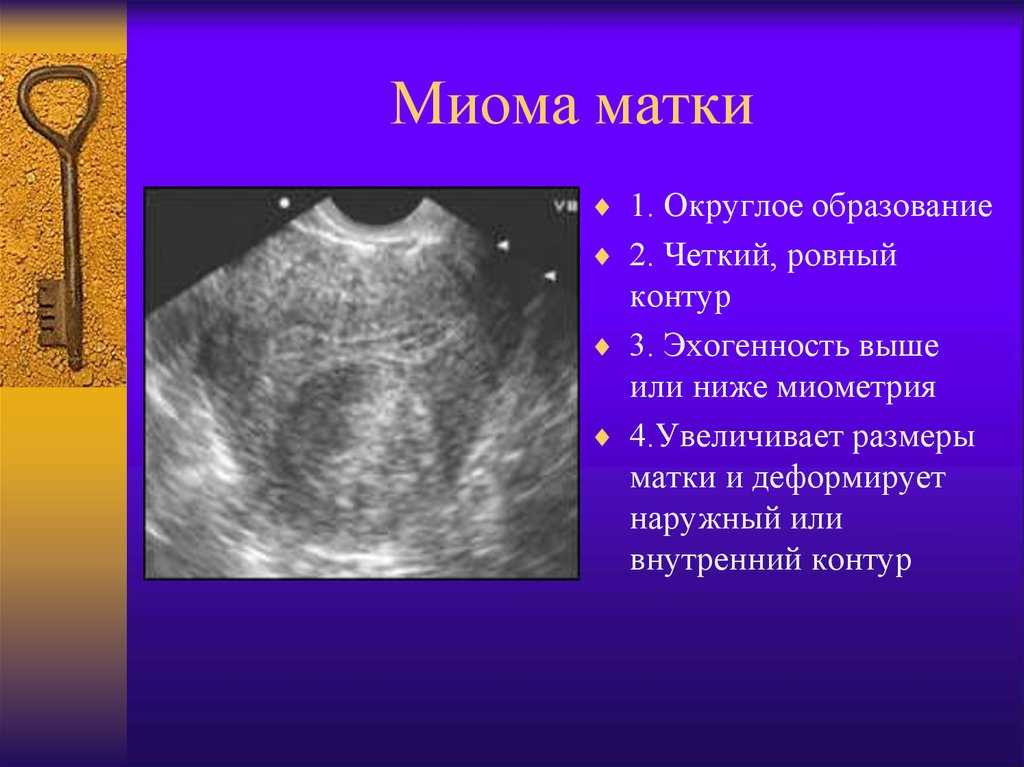 Миома матки размеры для операции, миома малых и больших размеров