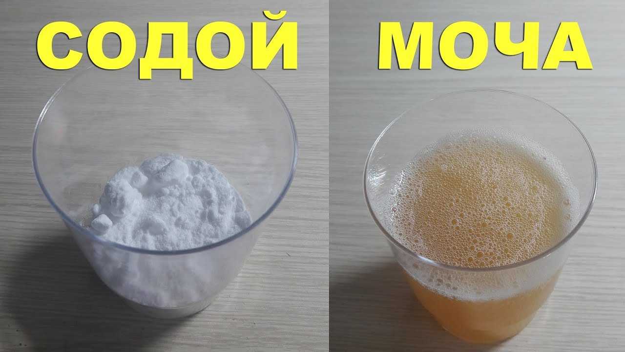 Определение беременности содой: как делать тест правильно