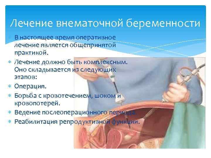 Внематочная беременность