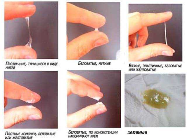 Скудные месячные - мнение эксперта