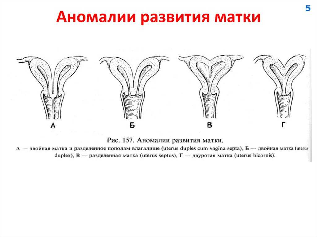 Аномалия развития и положения женских органов презентация