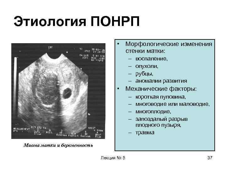 Отслоение плаценты на ранних сроках беременности - белая клиника