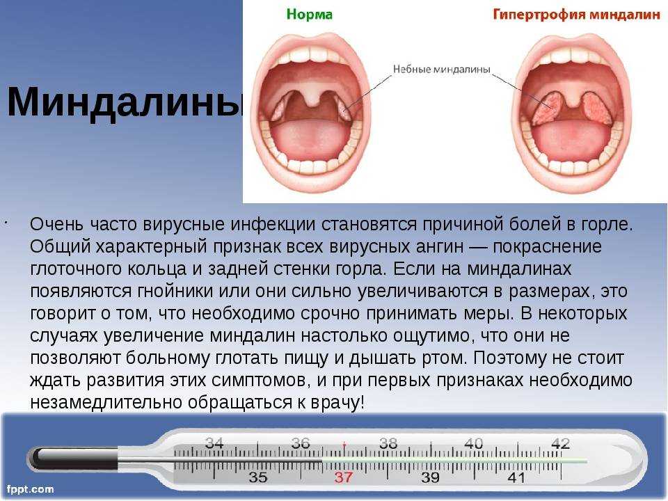Орфанные заболевания и связанные с ними проблемы | шашель | медицинский вестник юга россии