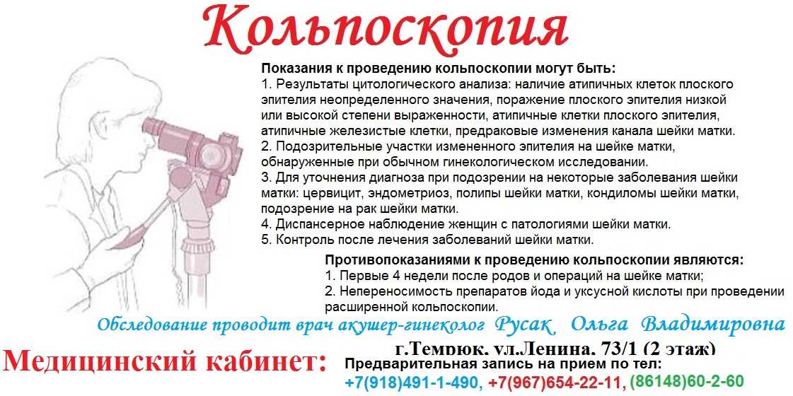 Загиб матки - можно ли забеременеть при загибе матки вправо или влево | национальный центр репродукции «эко-содействие»